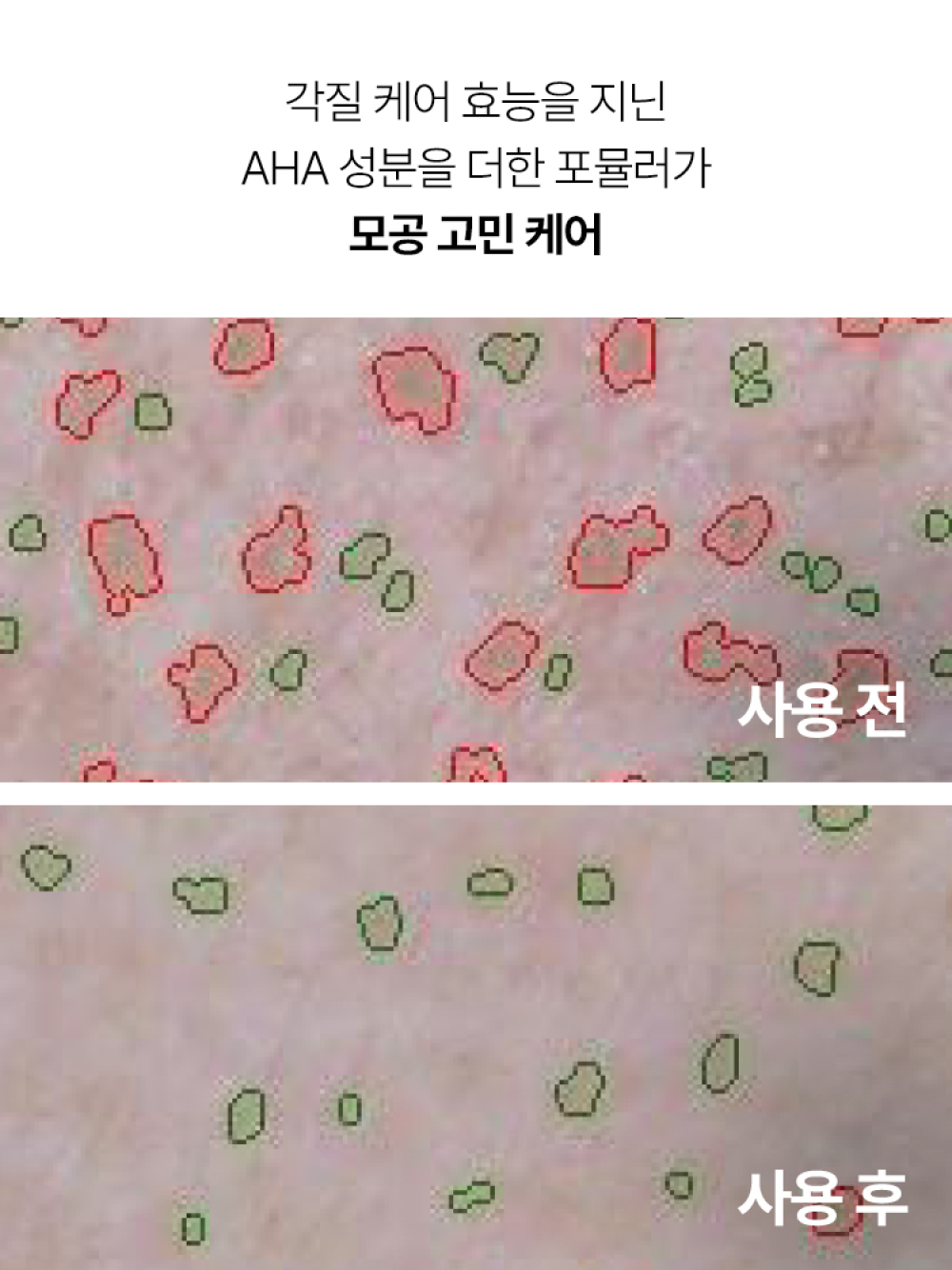 이니스프리 수퍼 화산송이 모공 마스크 100mL - 모공팩, 워시오프팩, 블랙헤드, 각질제거