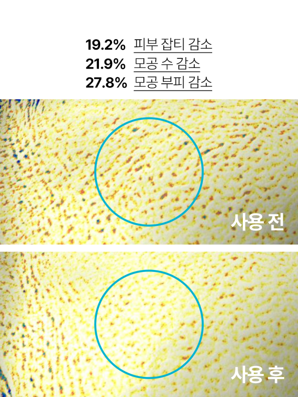 이니스프리 레티놀 시카 앰플 [대용량] x 2개 패키지 (50mL+50mL) - 수분앰플, 트러블, 흔적앰플, 진정앰플, 트러블앰플, 시카앰플