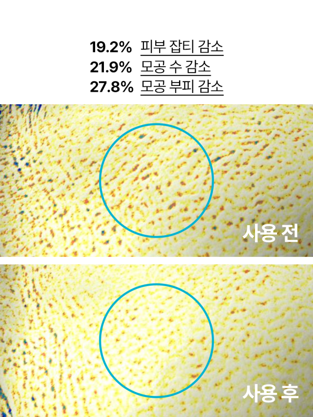 이니스프리 [2024 그린 홀리데이]  레티놀 시카 앰플 스페셜 세트 - 홀리데이한정, 트러블끝장케어, 깐달걀피부결, 트러블성피부, 저자극레티놀시카앰플, 레티놀시카